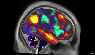 Illustration for article titled Estas son las imágenes más detalladas del cerebro jamás tomadas
